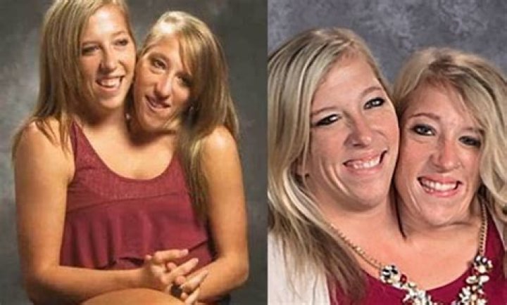 30 Fun Things About Conjoined Twins Abby and Brittany Hensel The Frisky