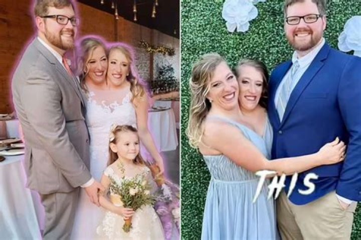 Abby and Brittany Hensel Dating, Net Worth 2021, Bio, Personal Life