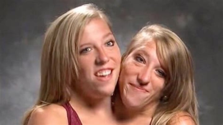 Abby And Brittany Hensel Finally Talks About Sex Life