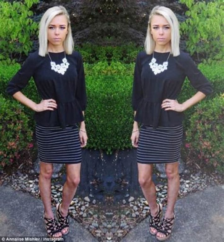 Annalise Mishler talks about anorexia recovery Daily Mail Online