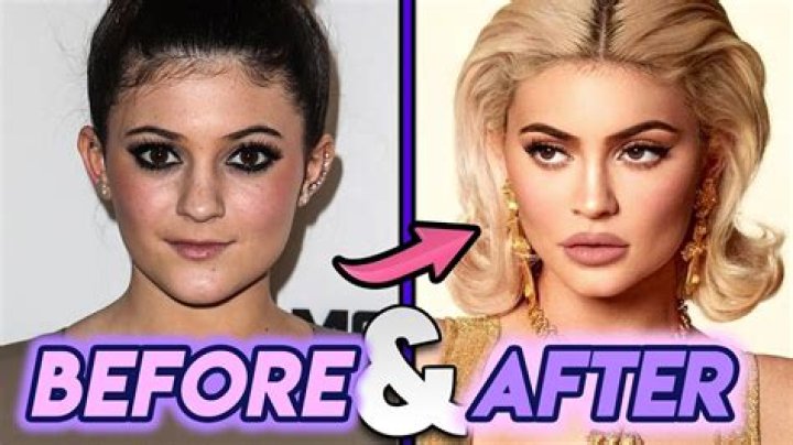 &Aring;! 27+ Grunner til Kylie Jenner Before Her face shape is slightly