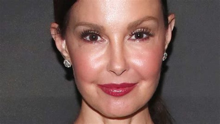 Ashley Judd Gives Health Update After Shattering Her Leg in the Congo