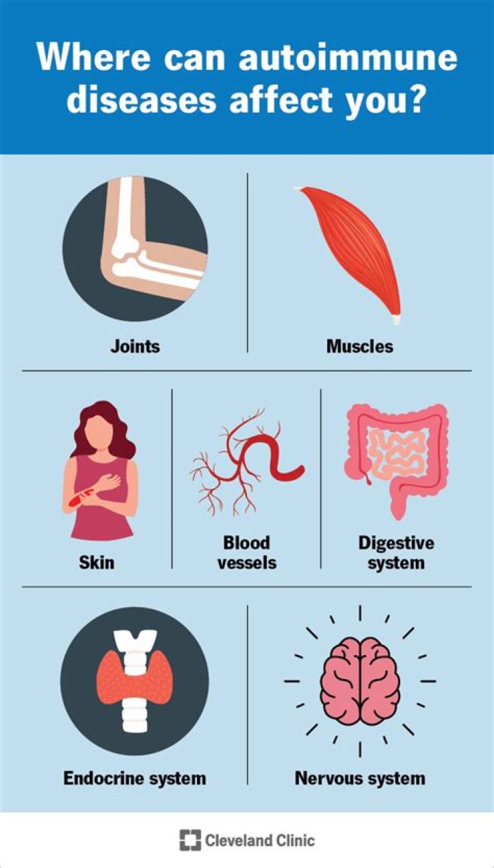 Autoimmune Diseases Symptoms and Treatments Scientific animations