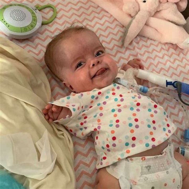 Baby with rare dwarfism is home after 184 days in hospital ABC News