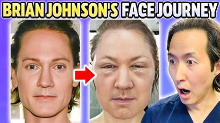 Bryan Johnson Plastic Surgery Before And After Photos