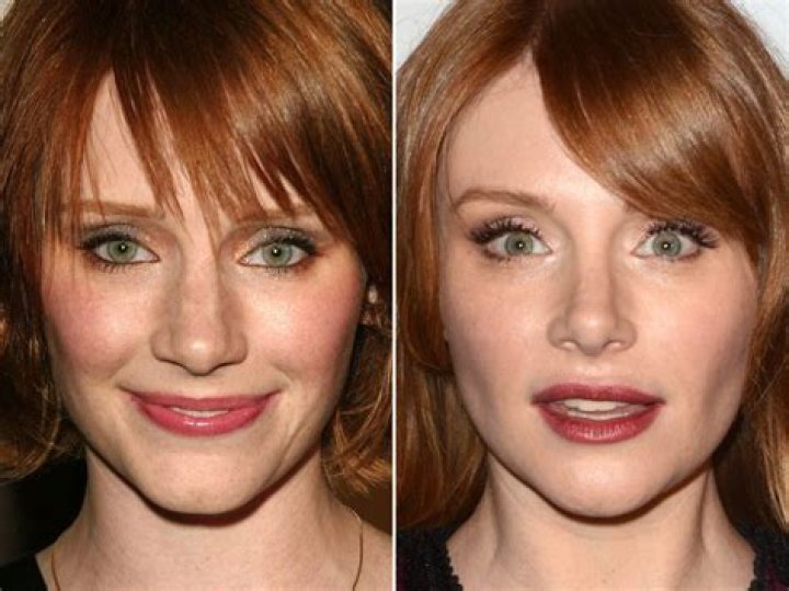 Bryce Dallas Howard before and after plastic surgery 15 Celebrity