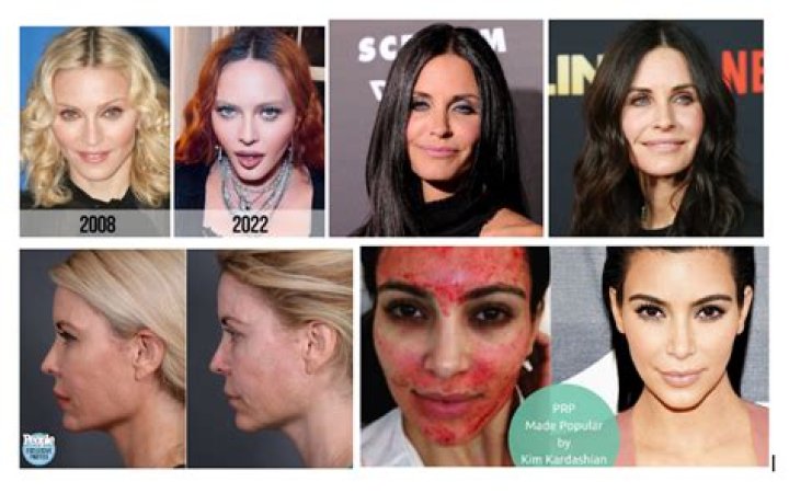 Celebrities with Facial Scars Health Guide Net