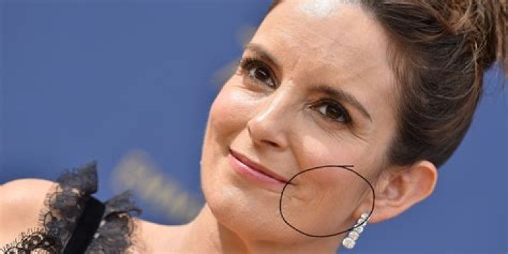 Celebrities with scars