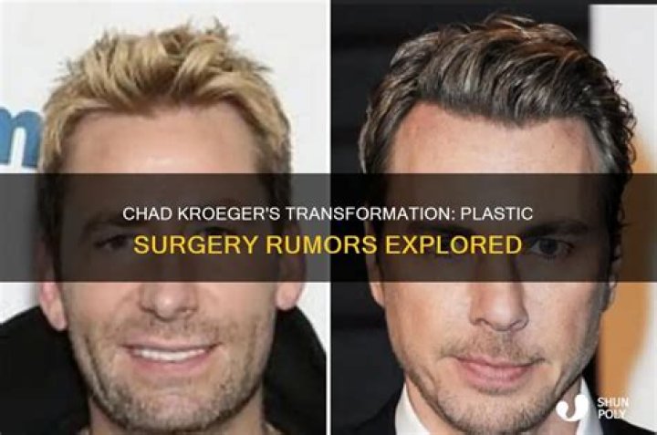 Chad Kroeger&rsquo;s Plastic Surgery The 48YearOld Canadian Singer&rsquo;s