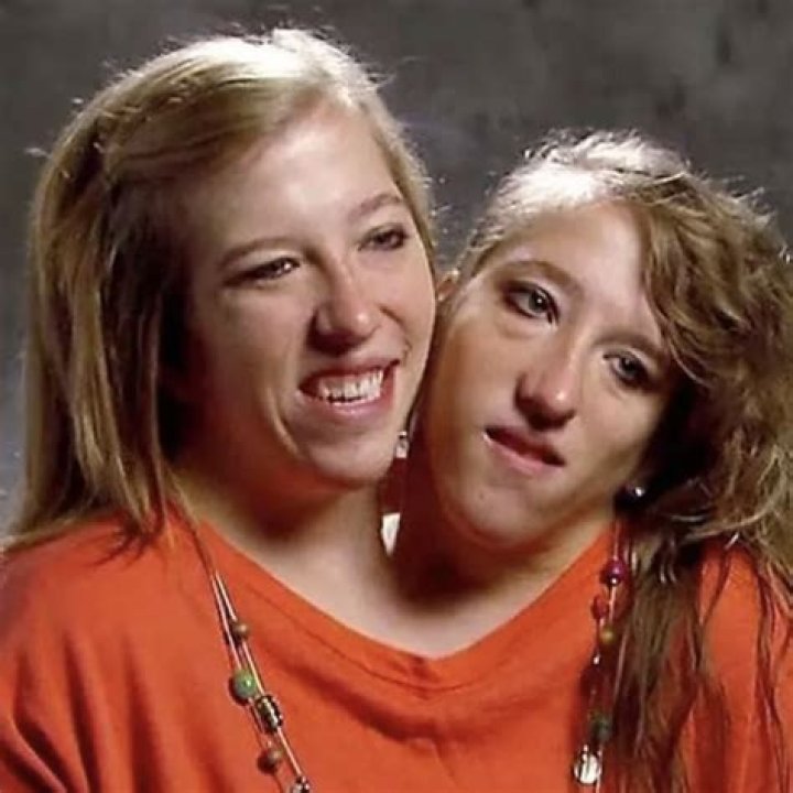 Conjoined twins Brittany and Abby Hensel respond to &lsquo;loud&rsquo; comments
