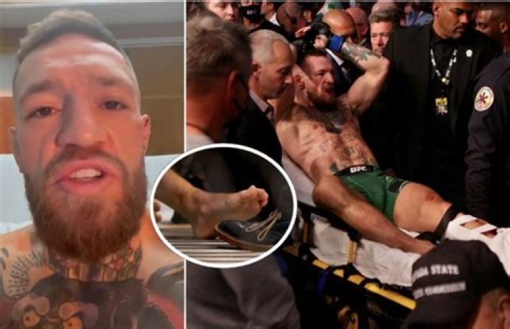 Conor McGregor to Get Surgery After Breaking Lower Left Leg The New