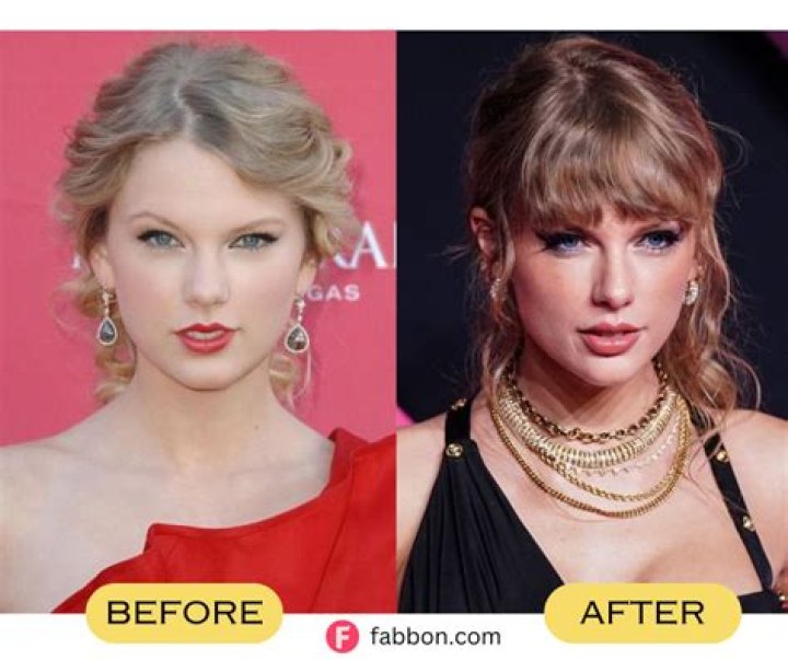 Did Taylor Swift Get Breast Implants?
