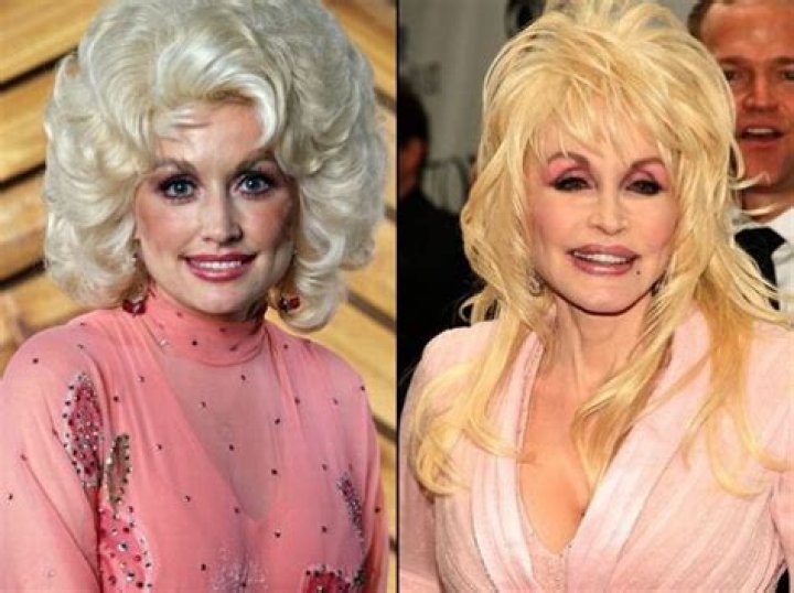 Dolly Parton aricuza kuba yarihinduje isura n... rwanda RwOT
