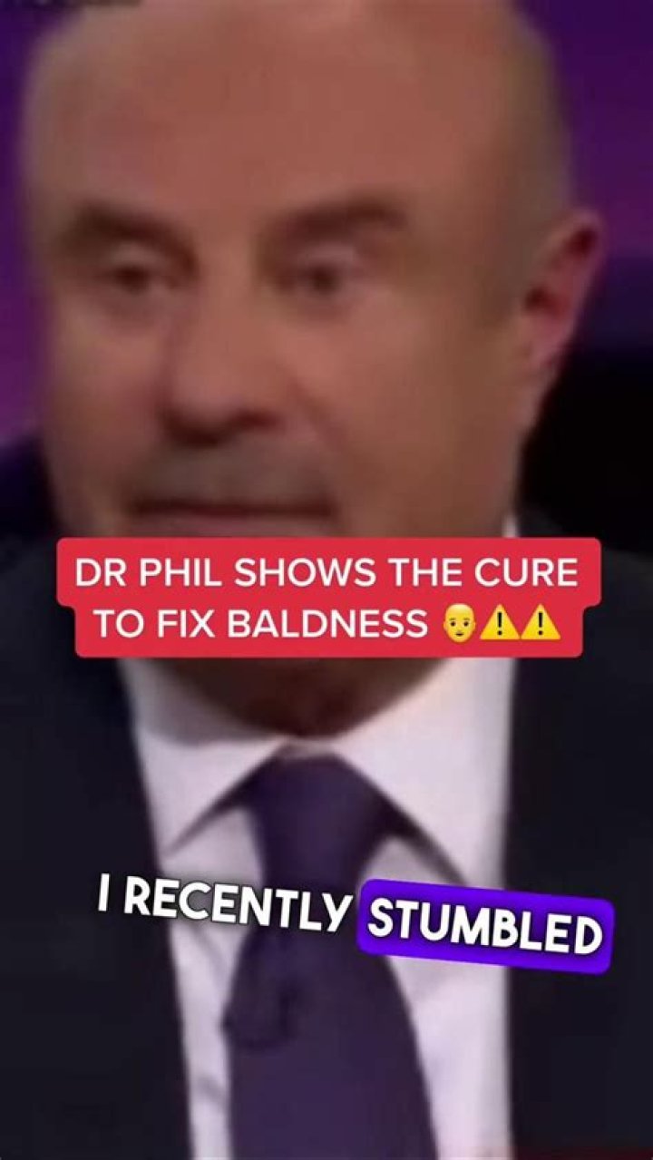 Dr. Phil Phil, Hair, Balding