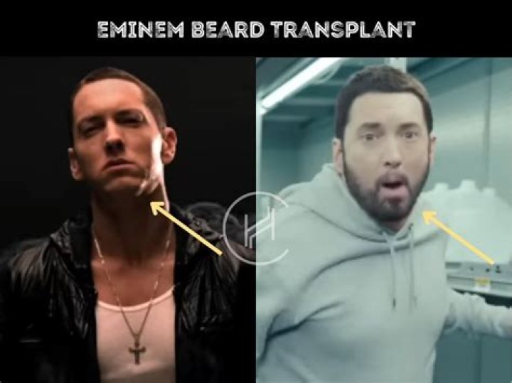 Eminem Has a Beard Now, Looks Totally Different Us Weekly