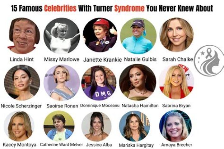Empowering Female Celebrities Battling Turner Syndrome