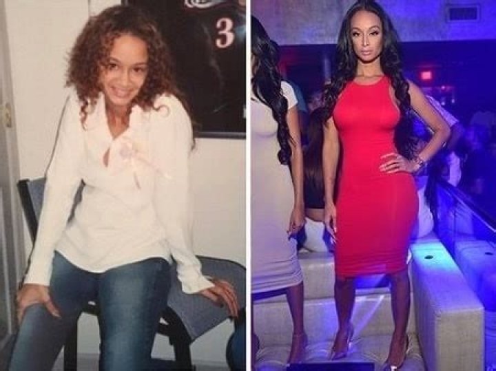 Erica Mena Before And After Plastic Surgery famousfaceshub