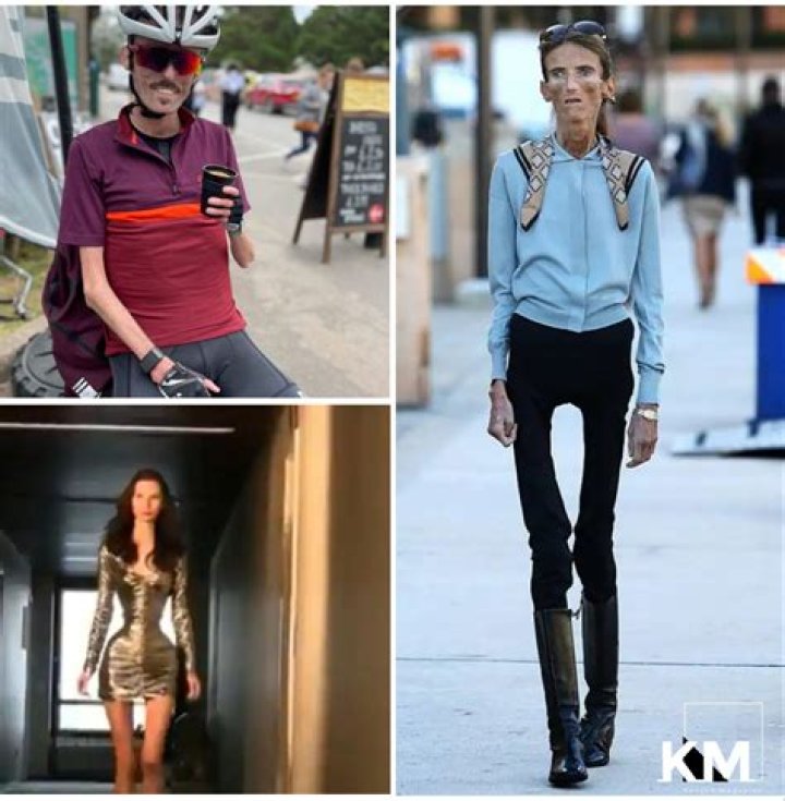 General 6 skinniest person in the world best, you should know BSS news