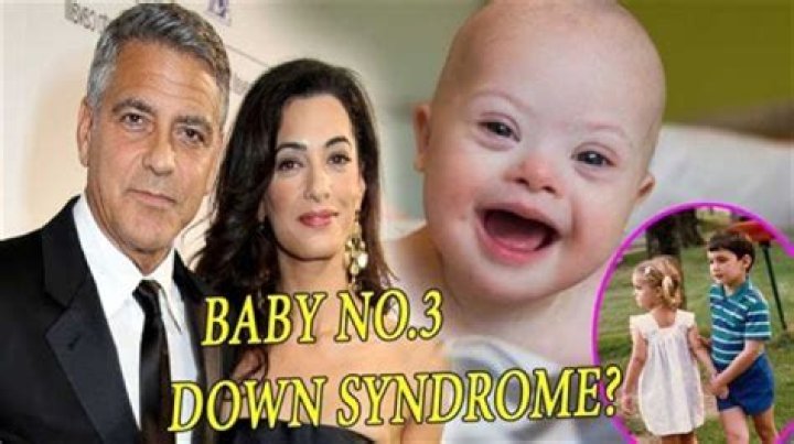 George Clooney's Inspiring Journey With His Down Syndrome Child