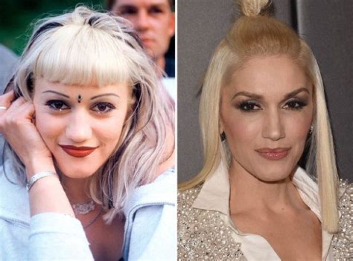 Gwen Stefani, Before and After The Skincare Edit