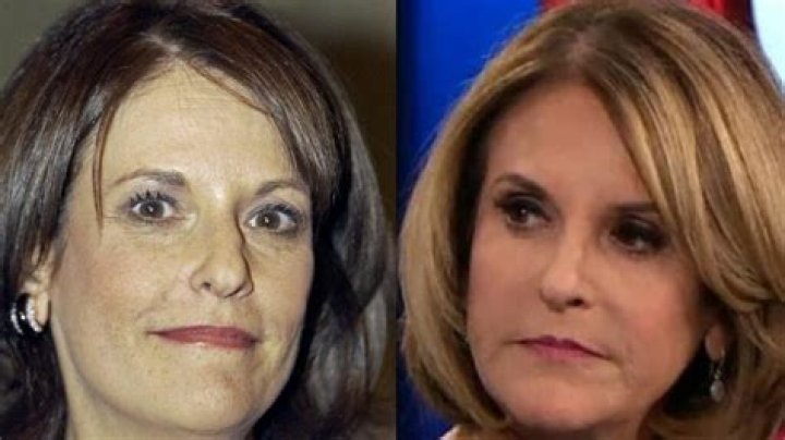 Has Gloria Undergone Plastic Surgery?