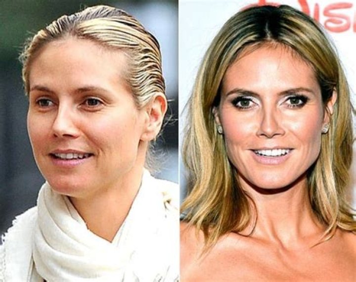Heidi Klum Plastic Surgery DE Heidi Klum