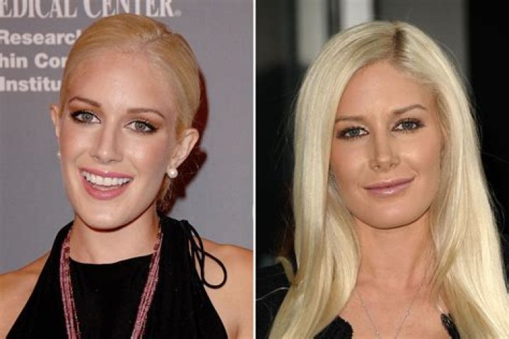 Heidi Montag Transformation Before Surgery: An Incredible Journey