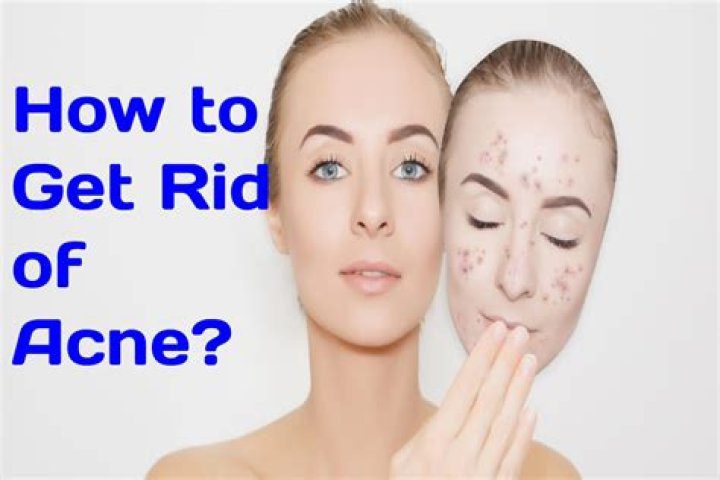 How To Get Rid Of Mosquitoes And Avoid Mosquito Bites lupon.gov.ph