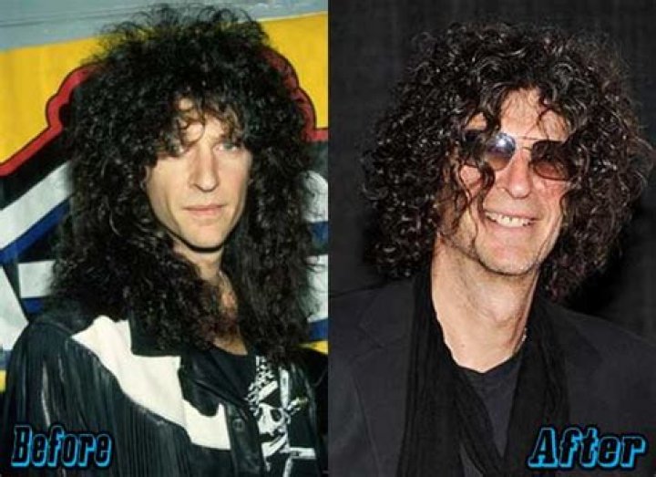 Howard Stern Before and After Plastic Surgery Nose, Face, Hair