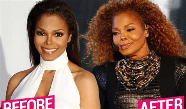 Jackson Unrecognizable After Massive Plastic Surgery Makeover