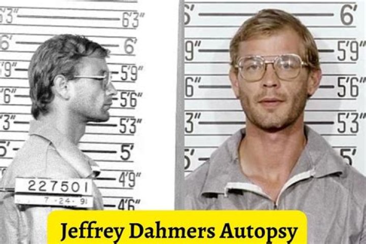 Jeffrey Dahmer Autopsy Report: Revealing The Dark Secrets