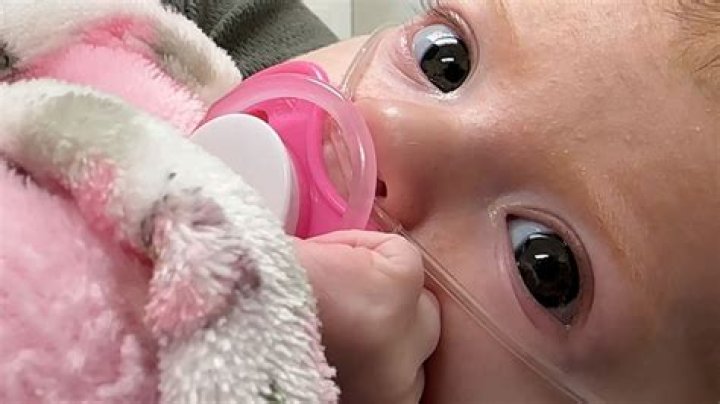 Kentucky baby diagnosed with rare form of dwarfism ABC7 San Francisco