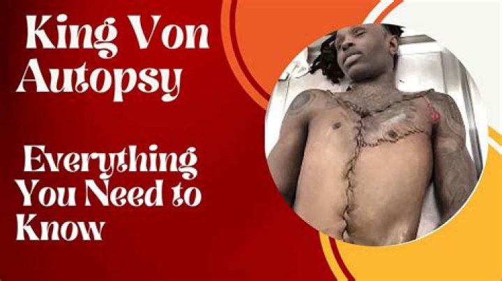King Vons Autopsy Photos Leaked Sensitive Content Street Juice Tv
