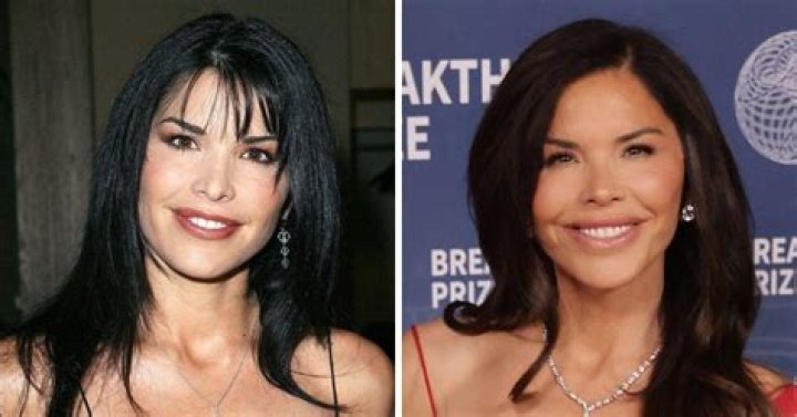 Lauren Sanchez Before Surgery Did She Underwent Surgery?