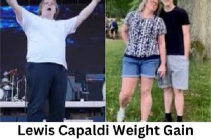 Lewis Capaldi&rsquo;s Weight Gain in 2023 The Singer Looks Way Too Heavier!