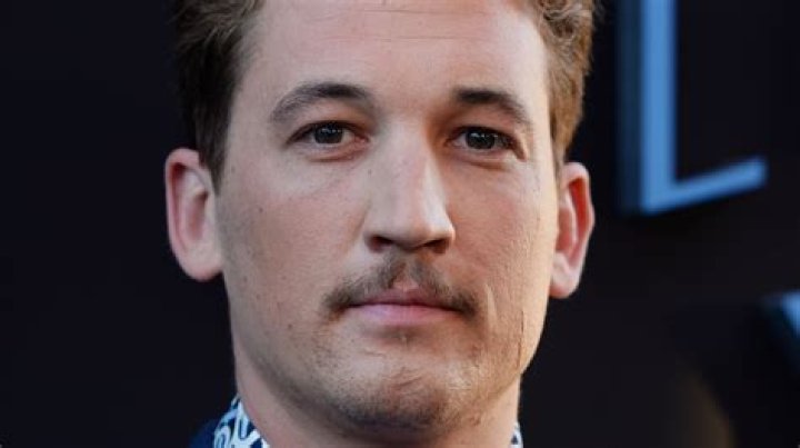 Miles Teller facial scars The story behind how the Top Gun Maverick