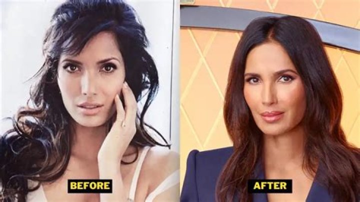Padma Lakshmi Plastic Surgery 2023. Her Skin Routine Details With