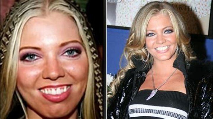 Paola Durante Antes Y Despues