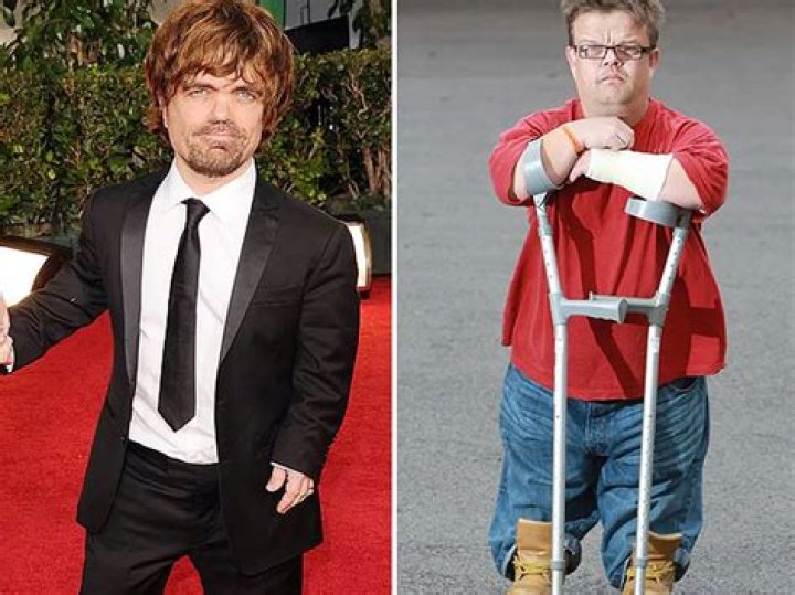 Peter Dinklage's Son Inherits Father's Dwarfism
