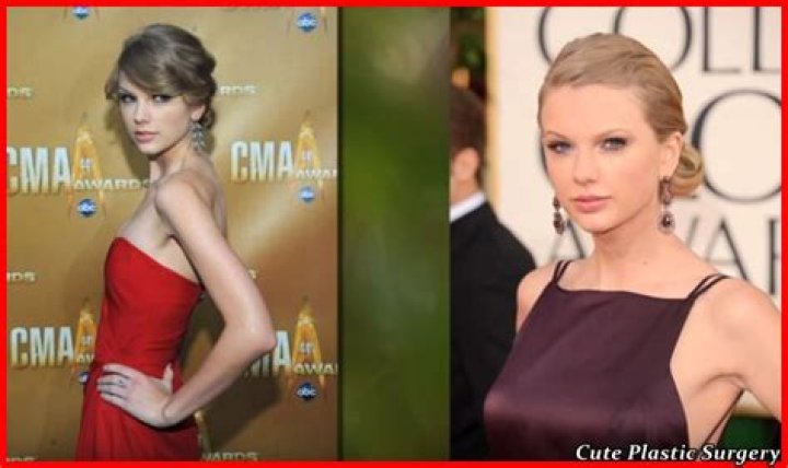 [PICS] Taylor Swift Breast Implants? See The Before And After Pics