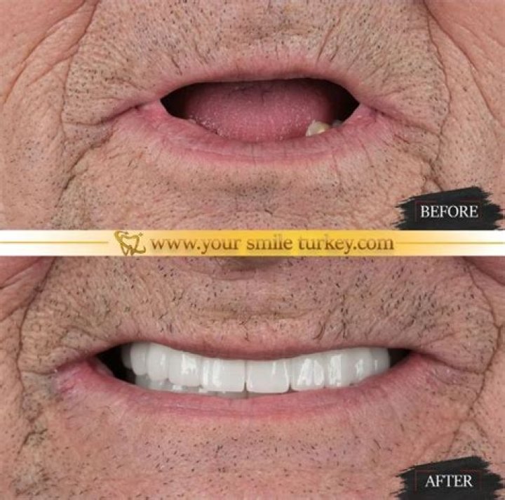 Pin on BEFORE AND AFTER