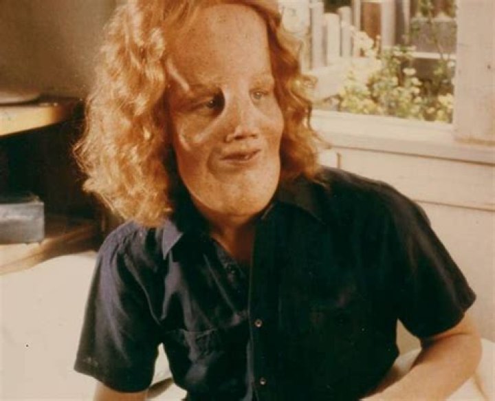 Rocky Dennis biography and intriguing realities Briefly.co.za