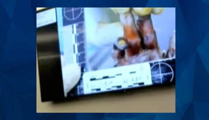 Shocking: Gannon Stauch Autopsy Photos Reveal Tragic Truth
