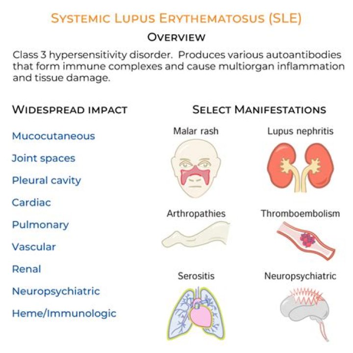 Systemic Lupus Erythematous Precision Rheumatology