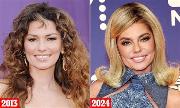 The Enduring Mystery: What Really Happened To Shania Twain's Face?