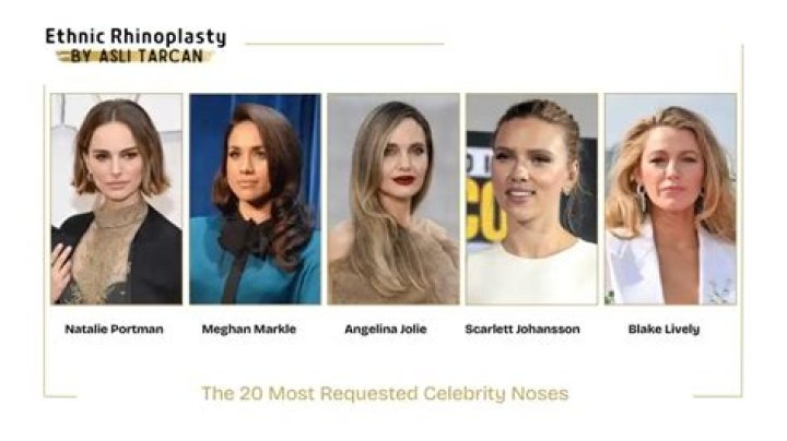 The Most SoughtAfter Celebrity Noses NewBeauty