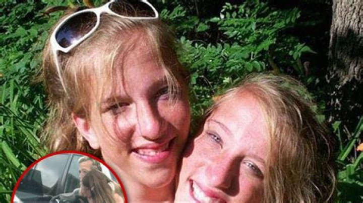 The Tragic Deaths Of Conjoined Twins Abby And Brittany Hensel