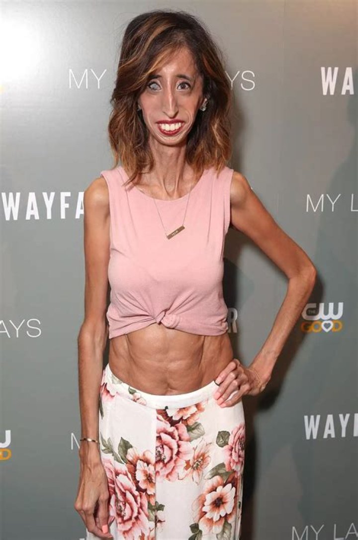 Thinnest Person In The World Ever