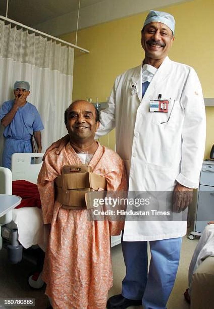 Three Feet Five Inches Tall Man Successfully Operated For Heart Bypass