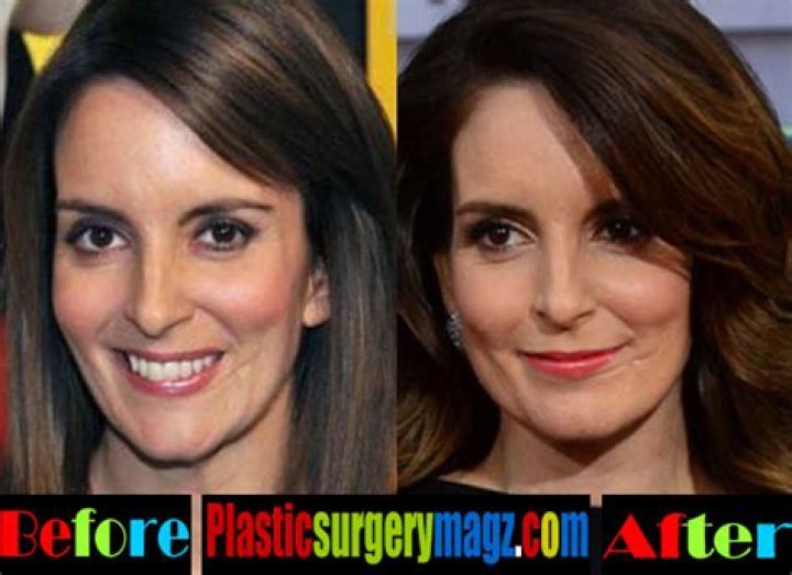 Tina Fey plastic surgery 12 Celebrity plastic surgery online